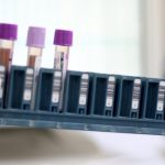 Ceará já conta com pontos de coleta para exame genético de doenças raras no SUS